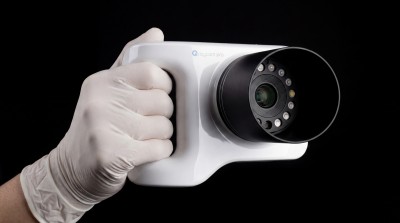KP-A411 : Intraoral imaging device for caries dete...